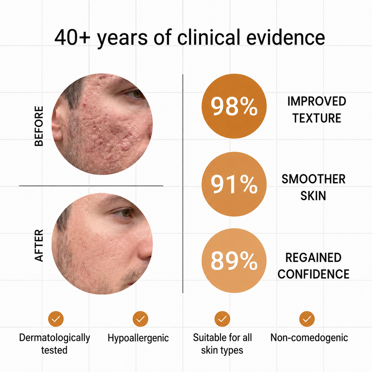 Next-Generation Acne Scar Stick